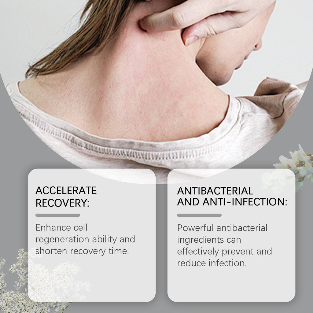 Skin Care Cream, Hydrates And Moisturizes The Body Skin To Relieve Dry Repair Skin Care Cream